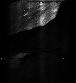 ascat_grayscale_ch1.png